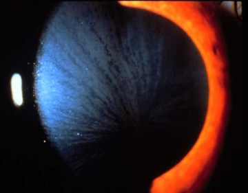 cornea verticillata